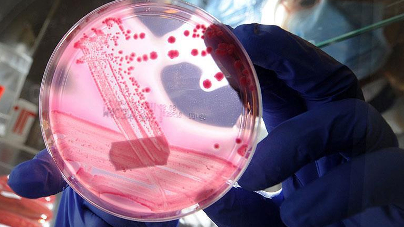 Natural discovery that can stop cancer from scientists