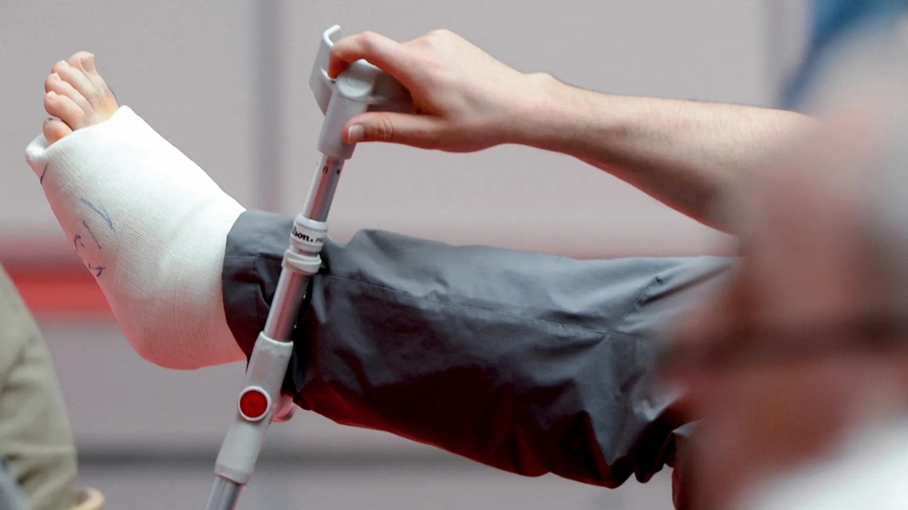 Broken leg (symbolic image): Private accident insurance covers accidents in your free time and at work.